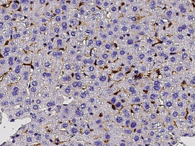 AIM Antibody in Immunohistochemistry (Paraffin) (IHC (P))