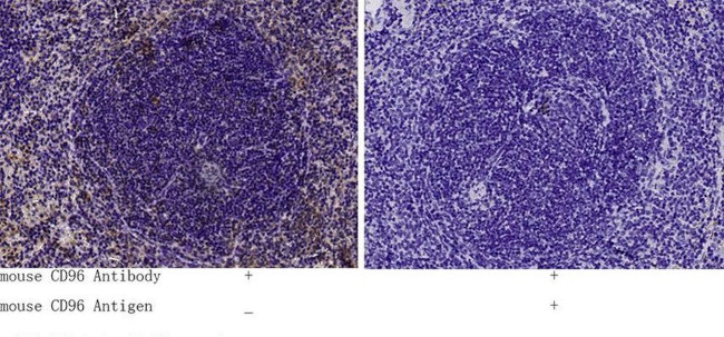 CD96 Antibody in Immunohistochemistry (Paraffin) (IHC (P))