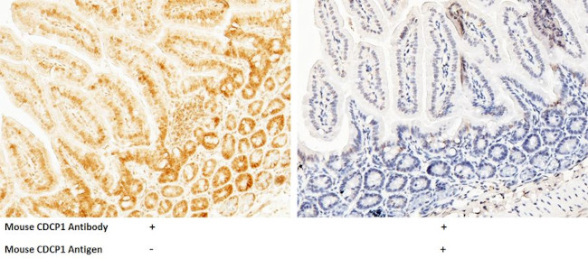 CDCP1 Antibody in Immunohistochemistry (Paraffin) (IHC (P))