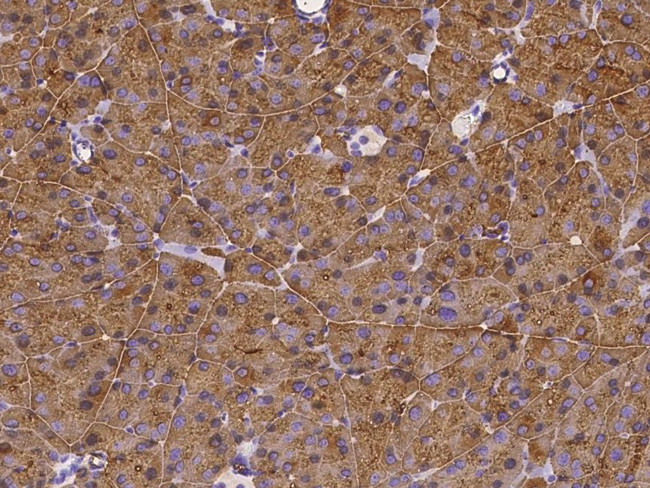 CEL Antibody in Immunohistochemistry (Paraffin) (IHC (P))