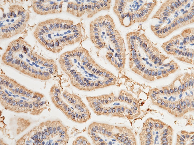 CES2 Antibody in Immunohistochemistry (Paraffin) (IHC (P))