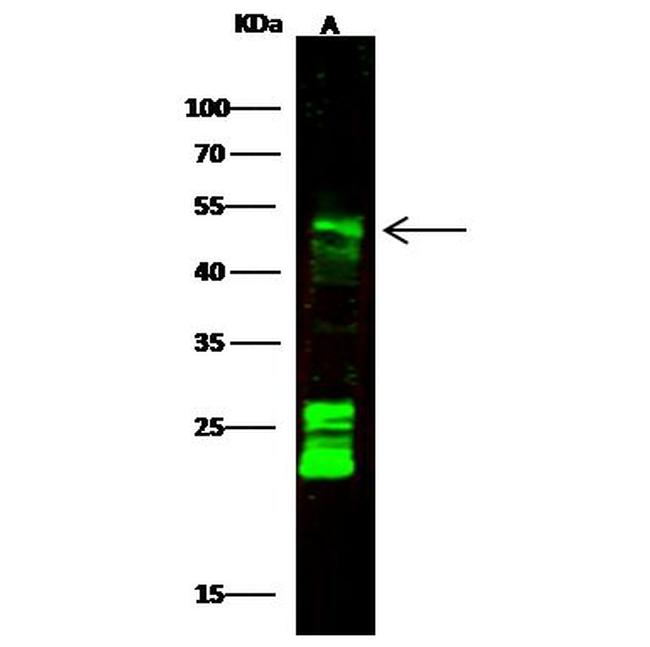 CNDP2 Antibody in Western Blot (WB)