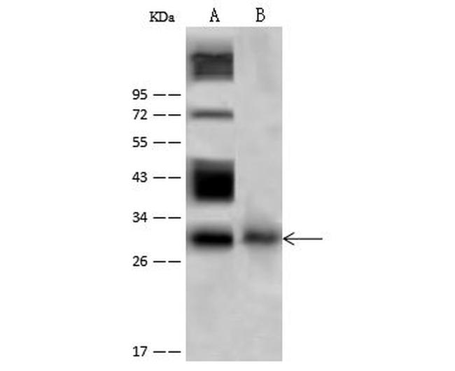 Neutrophil elastase Antibody in Western Blot (WB)