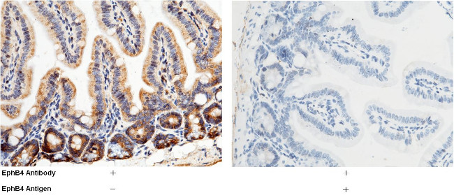 EphB4 Antibody in Immunohistochemistry (Paraffin) (IHC (P))