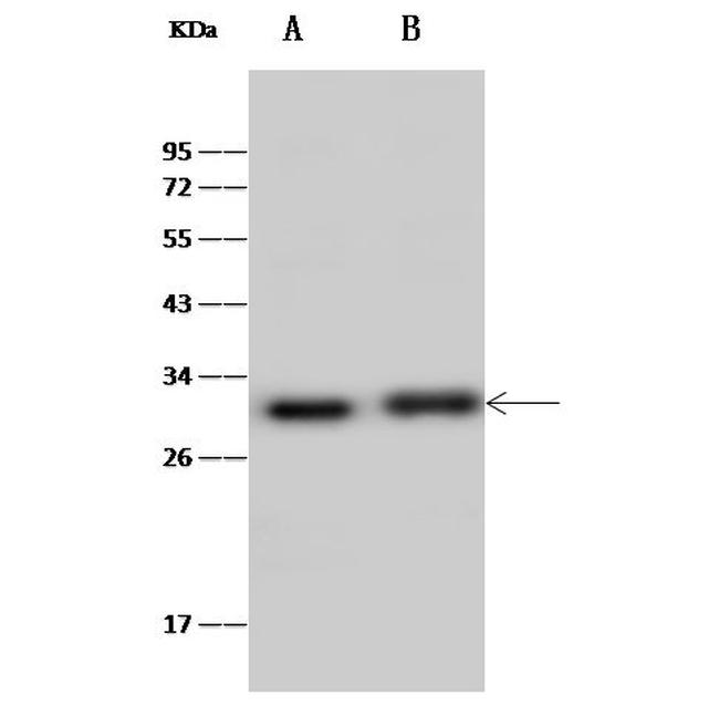 ERAS Antibody in Western Blot (WB)