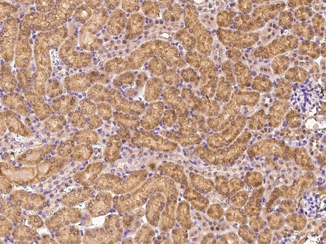 FGFR3 Antibody in Immunohistochemistry (Paraffin) (IHC (P))