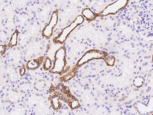 GGT1 Antibody in Immunohistochemistry (Paraffin) (IHC (P))