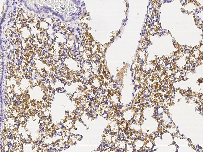 CD235a Antibody in Immunohistochemistry (Paraffin) (IHC (P))