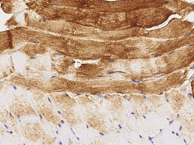IGFBP6 Antibody in Immunohistochemistry (Paraffin) (IHC (P))