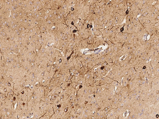 IL1F5 Antibody in Immunohistochemistry (Paraffin) (IHC (P))