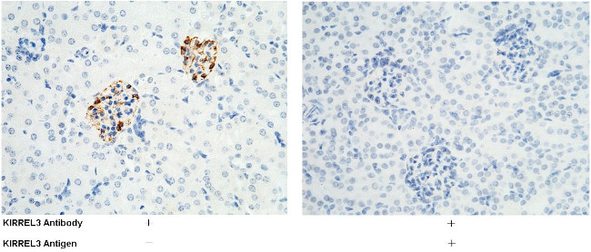 KIRREL3 Antibody in Immunohistochemistry (Paraffin) (IHC (P))