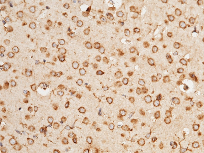 RAP Antibody in Immunohistochemistry (Paraffin) (IHC (P))