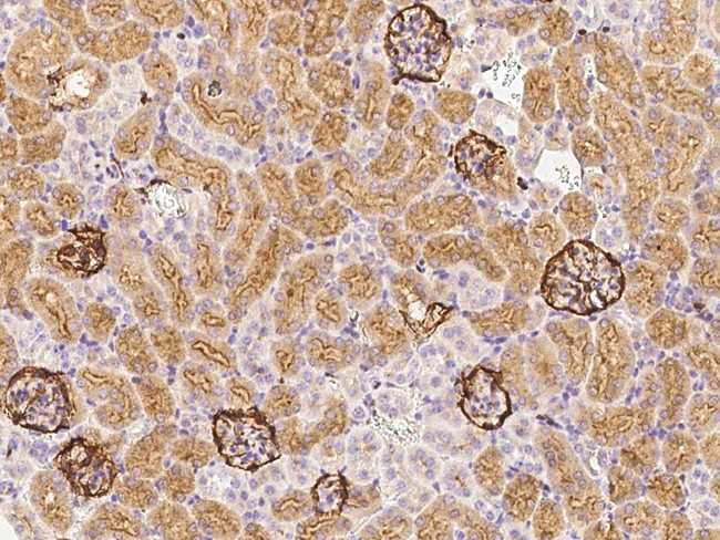 Podoplanin Antibody in Immunohistochemistry (Paraffin) (IHC (P))