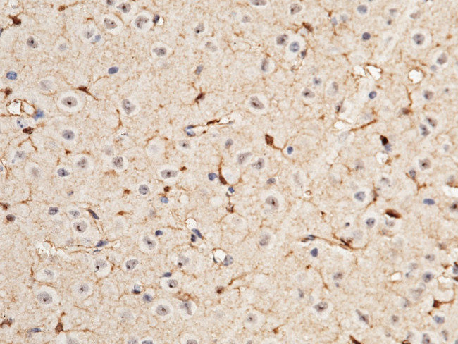 S100A1 Antibody in Immunohistochemistry (Paraffin) (IHC (P))
