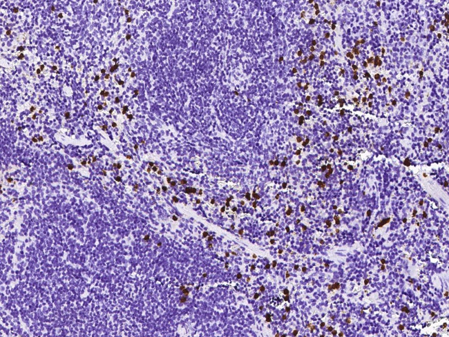 S100A8 Antibody in Immunohistochemistry (Paraffin) (IHC (P))