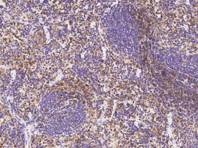 CD162 Antibody in Immunohistochemistry (Paraffin) (IHC (P))