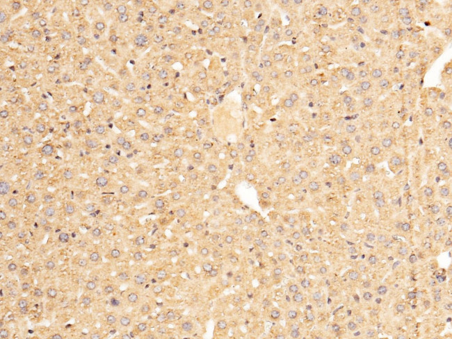 SERPINA7 Antibody in Immunohistochemistry (Paraffin) (IHC (P))