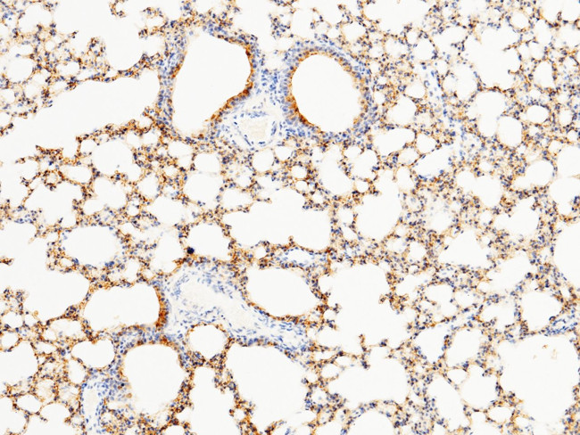 SFTPD Antibody in Immunohistochemistry (Paraffin) (IHC (P))