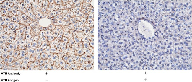 Vitronectin Antibody in Immunohistochemistry (Paraffin) (IHC (P))
