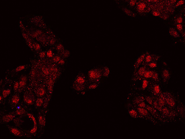 FOXP2 Antibody in Immunocytochemistry (ICC/IF)