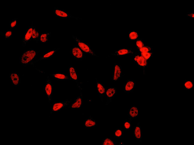 JMJD6 Antibody in Immunocytochemistry (ICC/IF)