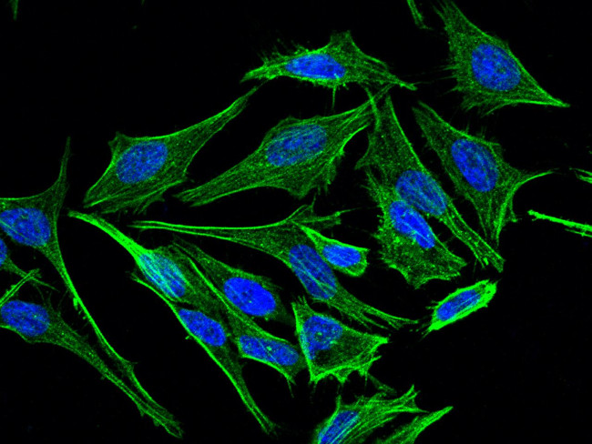 MEK1 Antibody in Immunocytochemistry (ICC/IF)