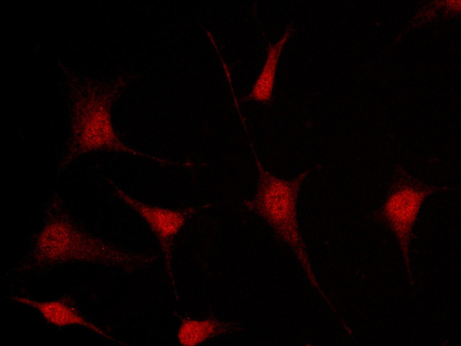 MSI1 Antibody in Immunocytochemistry (ICC/IF)