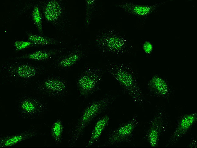 EBP1 Antibody in Immunocytochemistry (ICC/IF)
