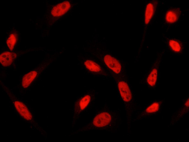 RbAp48 Antibody in Immunocytochemistry (ICC/IF)