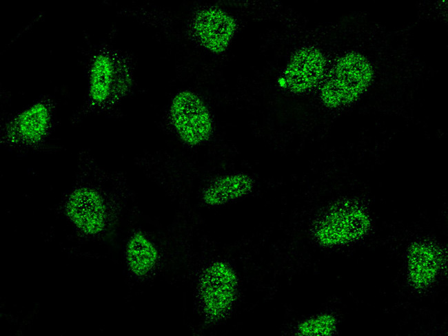 RING1 Antibody in Immunocytochemistry (ICC/IF)