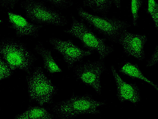 SMG1 Antibody in Immunocytochemistry (ICC/IF)
