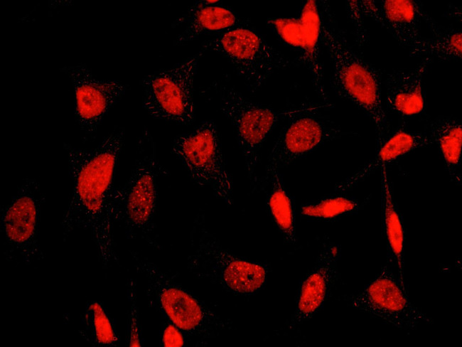 SUMO2 Antibody in Immunocytochemistry (ICC/IF)