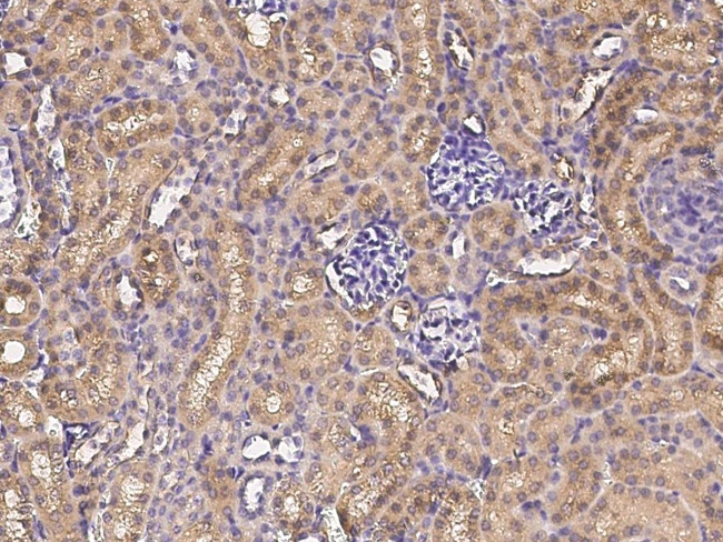 CD171 Antibody in Immunohistochemistry (Paraffin) (IHC (P))