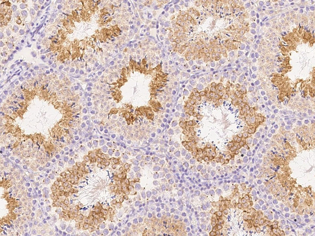 ANGEL1 Antibody in Immunohistochemistry (Paraffin) (IHC (P))