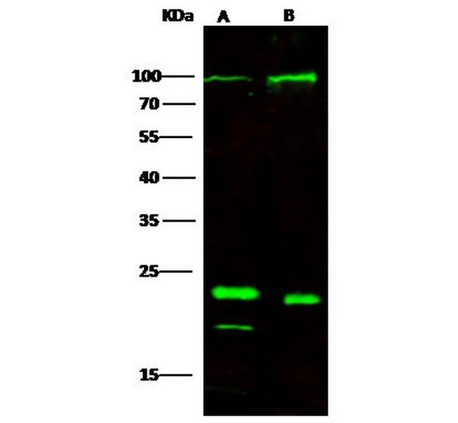 P-Selectin Antibody in Western Blot (WB)