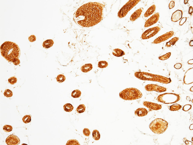 CD166 Antibody in Immunohistochemistry (Paraffin) (IHC (P))