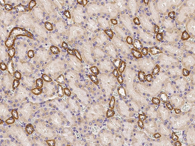 CD297 Antibody in Immunohistochemistry (Paraffin) (IHC (P))
