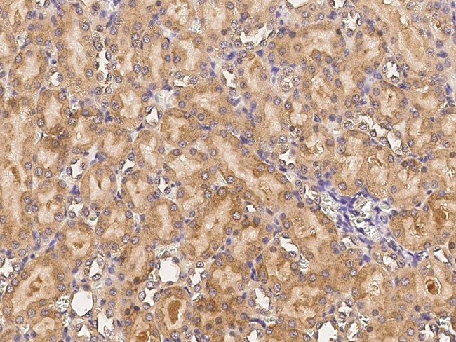 CDH8 Antibody in Immunohistochemistry (Paraffin) (IHC (P))