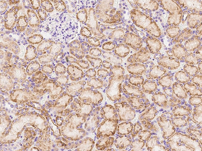 CXCL16 Antibody in Immunohistochemistry (Paraffin) (IHC (P))