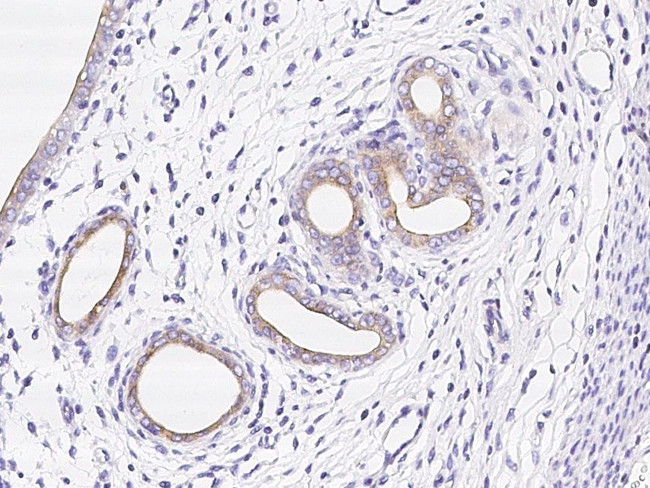 WFDC2 Antibody in Immunohistochemistry (Paraffin) (IHC (P))
