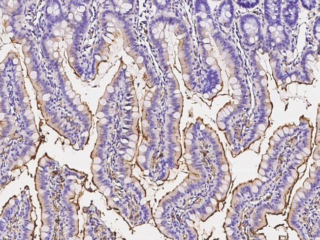 CD13 Antibody in Immunohistochemistry (Paraffin) (IHC (P))