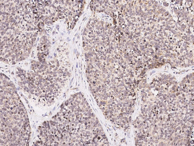 NPY Antibody in Immunohistochemistry (Paraffin) (IHC (P))