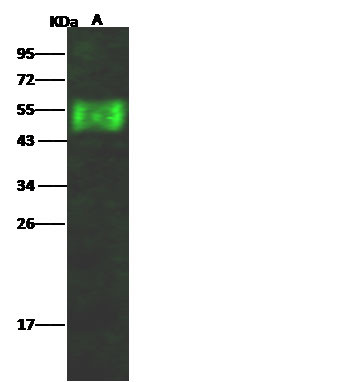 Influenza A H17N10 HA (A/little yellow-shouldered bat/Guatemala/164/2009) Antibody in Western Blot (WB)