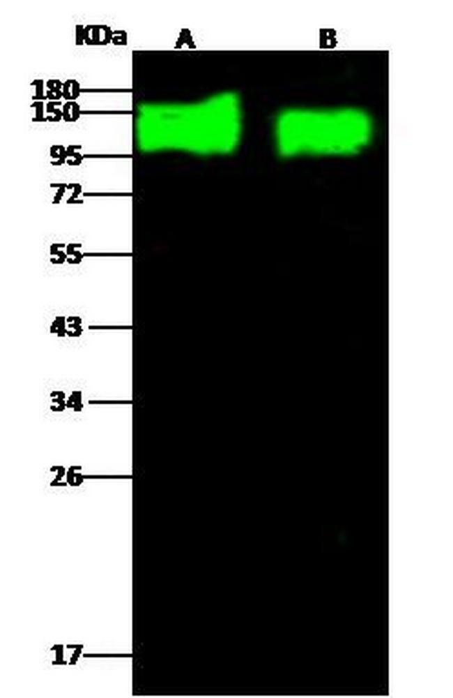 HIV1 gp120 Antibody in Western Blot (WB)