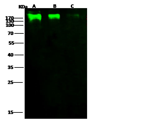 HIV1 gp140 (group M, subtype CRF07_BC) Antibody in Western Blot (WB)