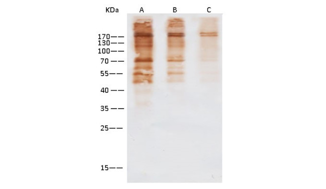 MERS Coronavirus Spike Protein Antibody in Western Blot (WB)