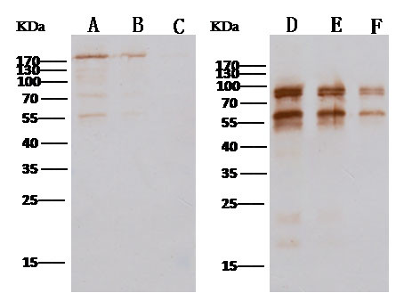 MERS Coronavirus Spike Protein S2 Antibody in Western Blot (WB)