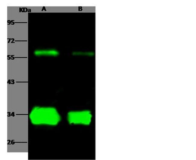 SARS Coronavirus Spike Protein Antibody in Western Blot (WB)