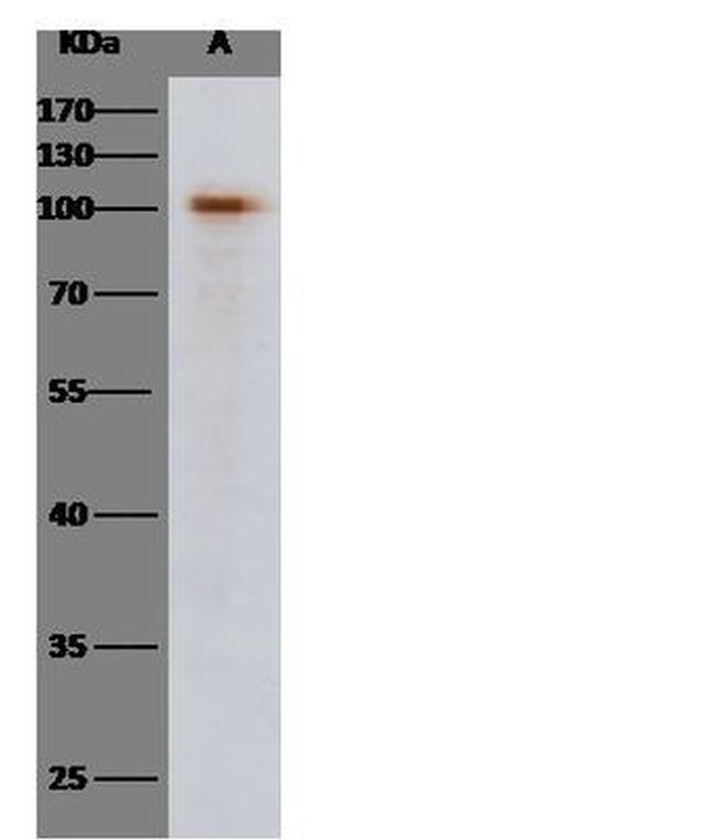 SARS Coronavirus Spike Protein (subunit 1) Antibody in Western Blot (WB)
