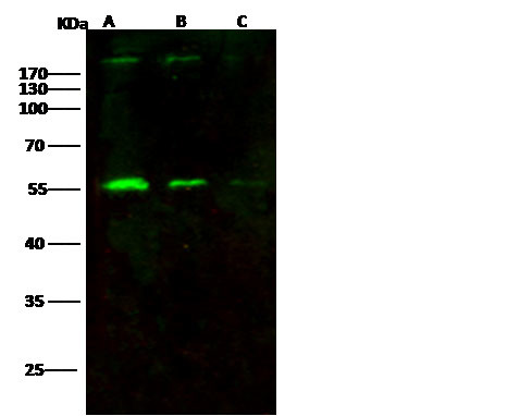 HIV p51 (group M, subtype B (isolate HXB2)) Antibody in Western Blot (WB)